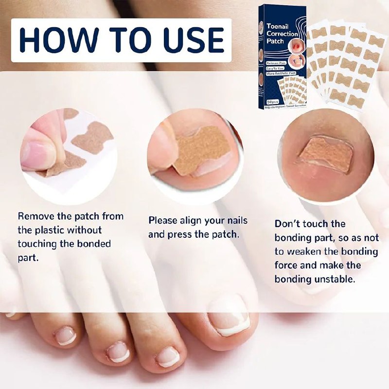 Patchs de correction pour ongles incarnés رقعة تصحيحية لأظافر القدمين النامية تحت الجلد