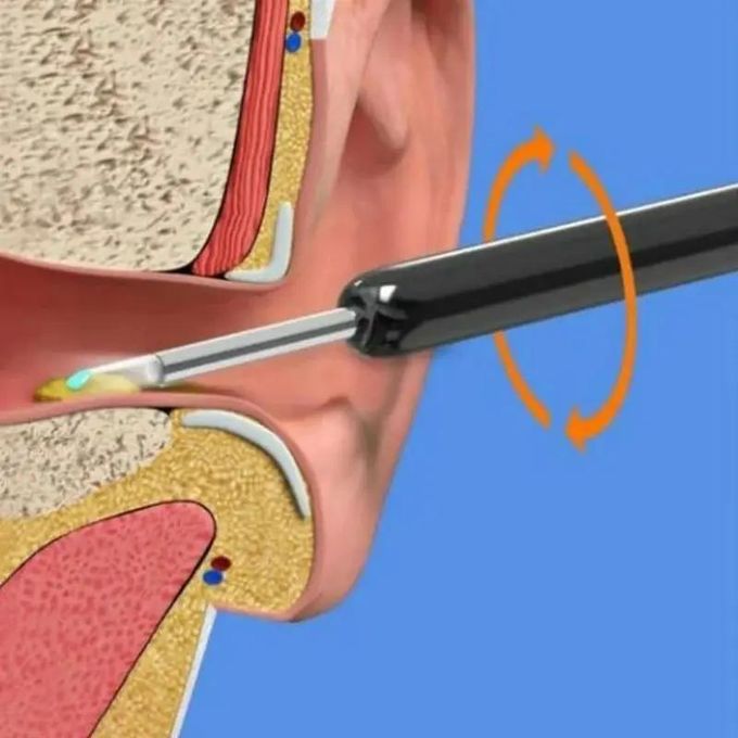 منظف الأذن بكاميرا عالية الدقة منظار الأذن الاندوسكوب اللاسلكي Nettoyeur d’Oreille avec Caméra HD