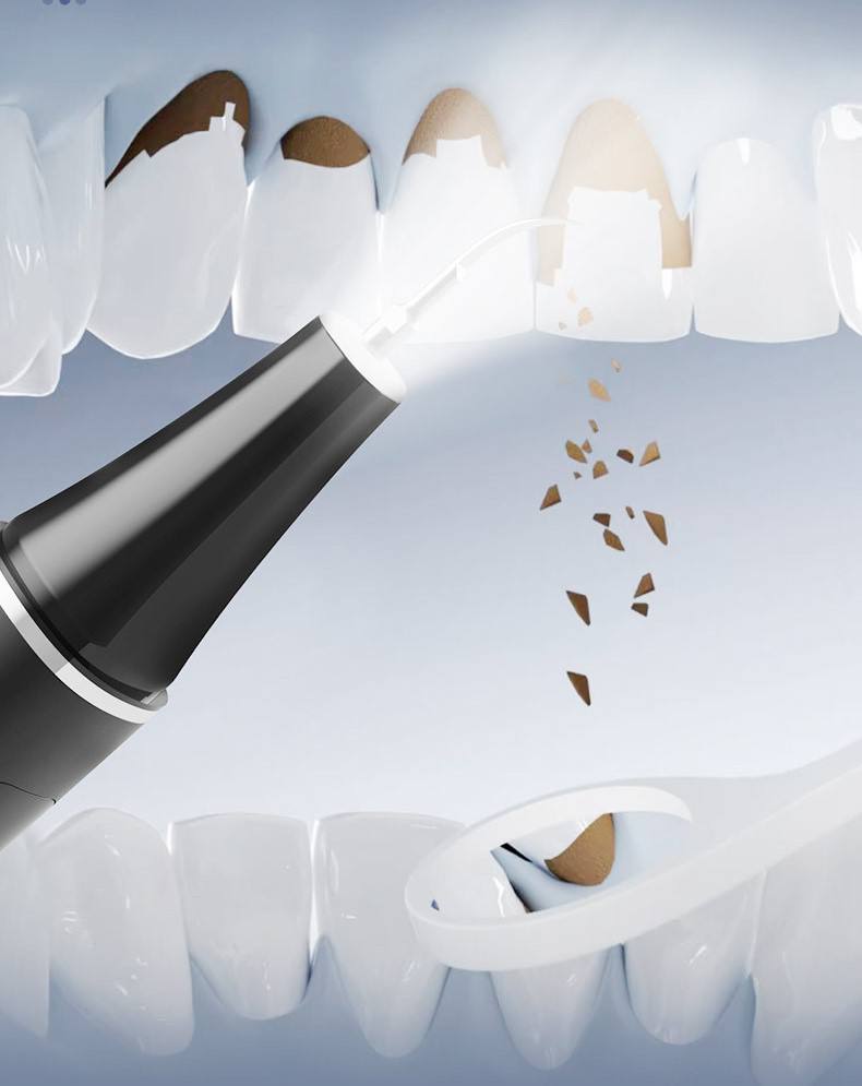 جهاز تنظيف الأسنان الكهربائي Détartreur dentaire électrique et nettoyeur de dents