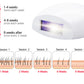 جهاز إزالة الشعر بالليزر عالي الجودة، نظام إزالة الشعر بتقنية Machine Epilateur laser haute qualité système d'épilation IPL