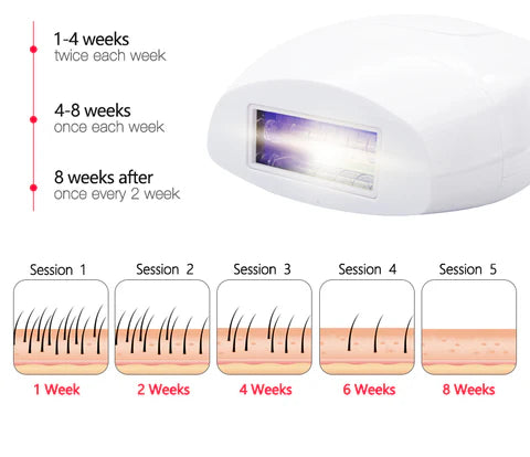 جهاز إزالة الشعر بالليزر عالي الجودة، نظام إزالة الشعر بتقنية Machine Epilateur laser haute qualité système d'épilation IPL
