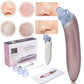 جهاز تنظيف البشرة وإزالة البقع السوداء من الوجه XN-8030