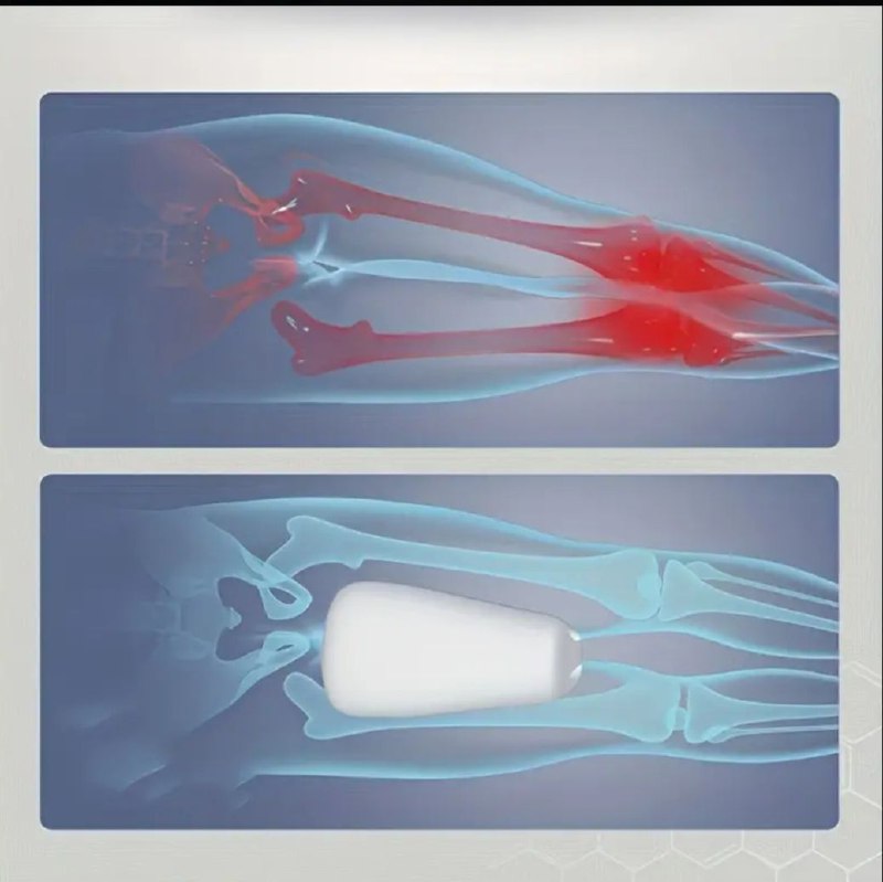 وسادة إسفنجية للعظام، وسادة طبية للساق، وسادة للركبة Coussin orthopédique à mémoire de forme,Oreiller de Jambe Médical,Oreiller de Genou