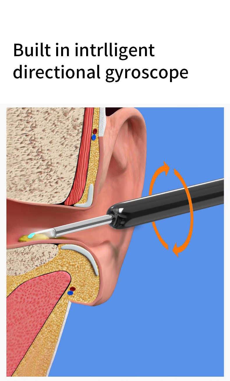 NE3 Nettoyeur d’oreilles intelligent avec caméra LED منظار الأذن الذكي اللاسلكي