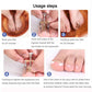 أداة تصحيح أظافر القدم الغارزة في اللحم Outil d'ongle Incarné de Correction de Style D'ongle