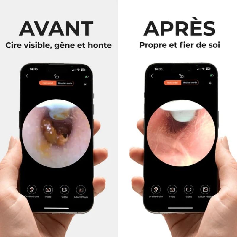 Cure-Oreilles Visible Sans Fil NE3 HD avec Recharge Type-C منظف الأذن اللاسلكي المرئي NE3