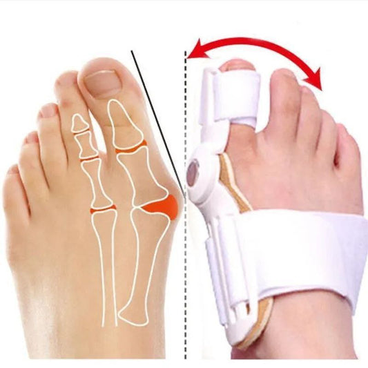 Correcteur d'hallux Valgus, oignon pour orteils, séparateur de doigts مصحح إبهام القدم الأروح، مصحح الورم، فاصل أصابع القدم