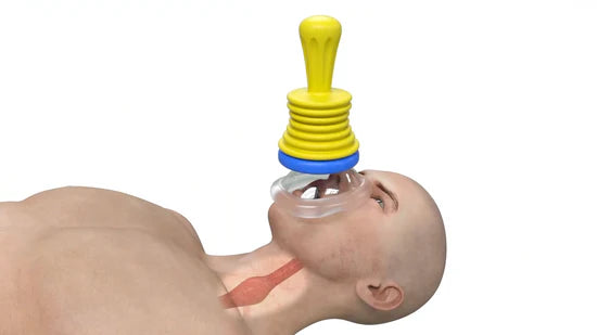 مجموعة أدوات مساعدة محمولة مكونة من 8 قطع تساعد على إزالة الأجسام العالقة Kit d'assistance portable 8 pièces pour retirer les objets obstrués, kit anti-étouffement pratique pour enfants et adultes